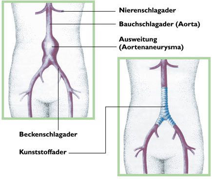 Halsschlagader